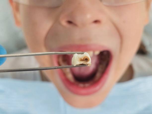 Best Emergency Denture Repair in Troy, TX